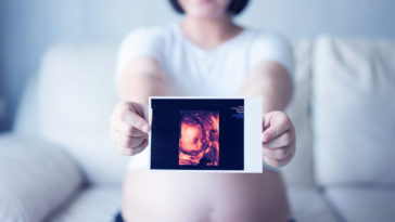 Embarazo después de los 35 ecografia