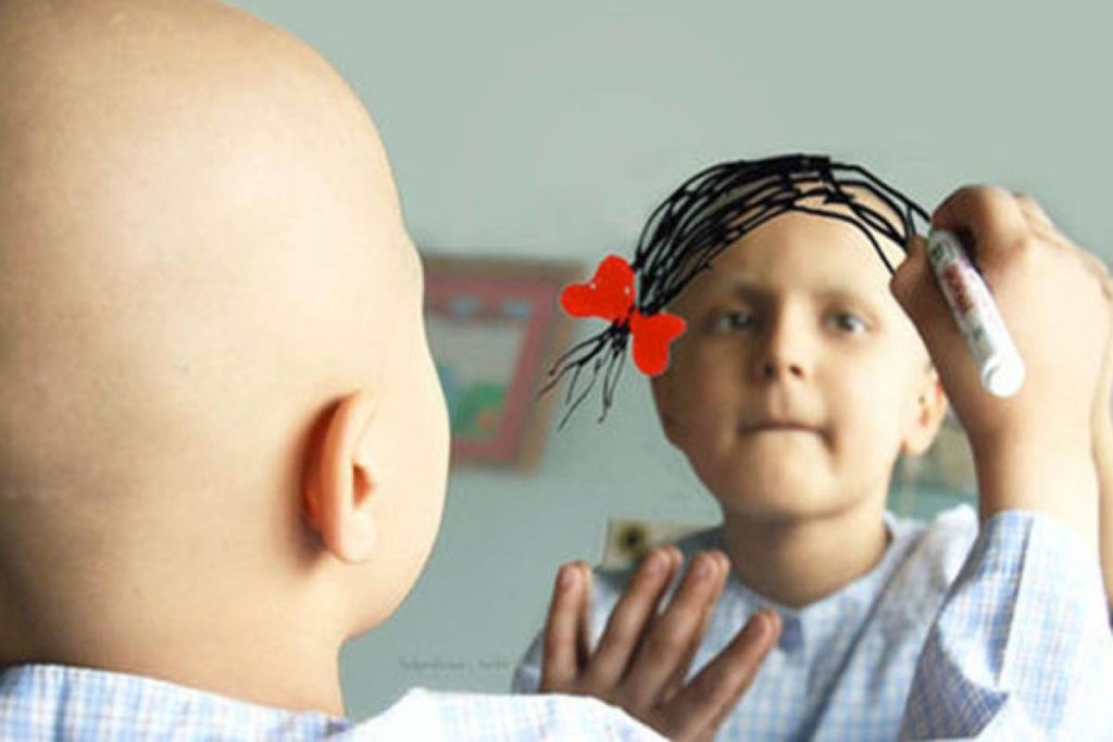 señales de Leucemia en los niños