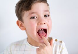 diente flojo y el ratón pérez - niño sin diente